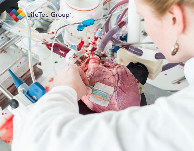 PhysioHeart Electrophysiology