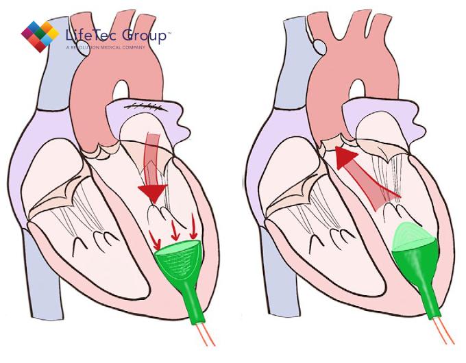 webimage cardiac booster