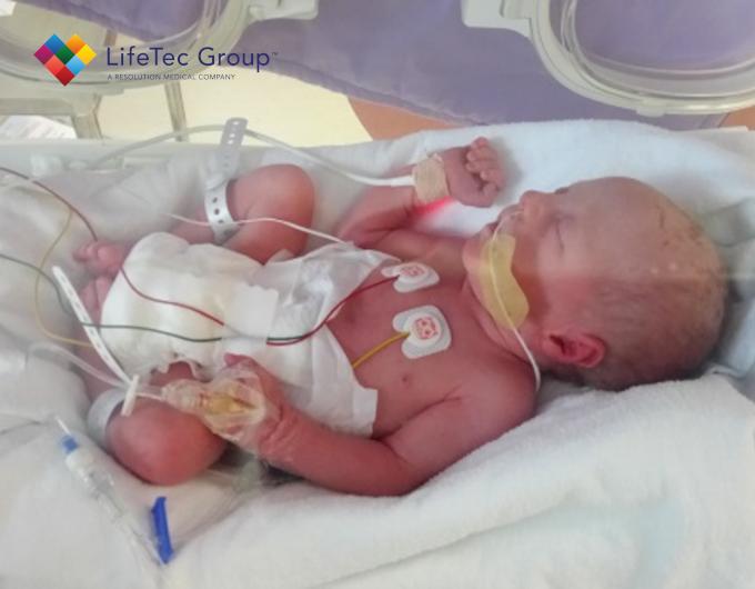 Preterm baby in air-based incubator