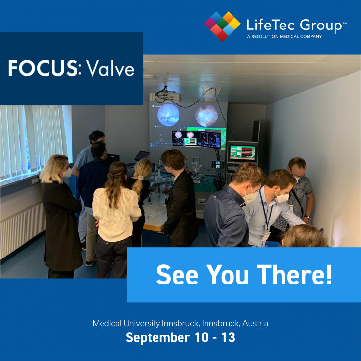 Focus Valve