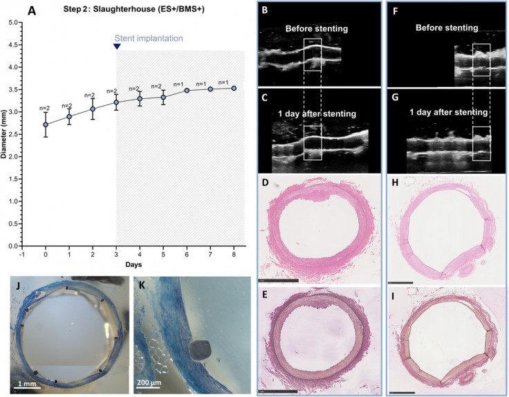 stent and echo slaughter.jpg