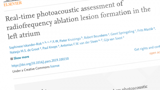 Paper photoacoustic assessment
